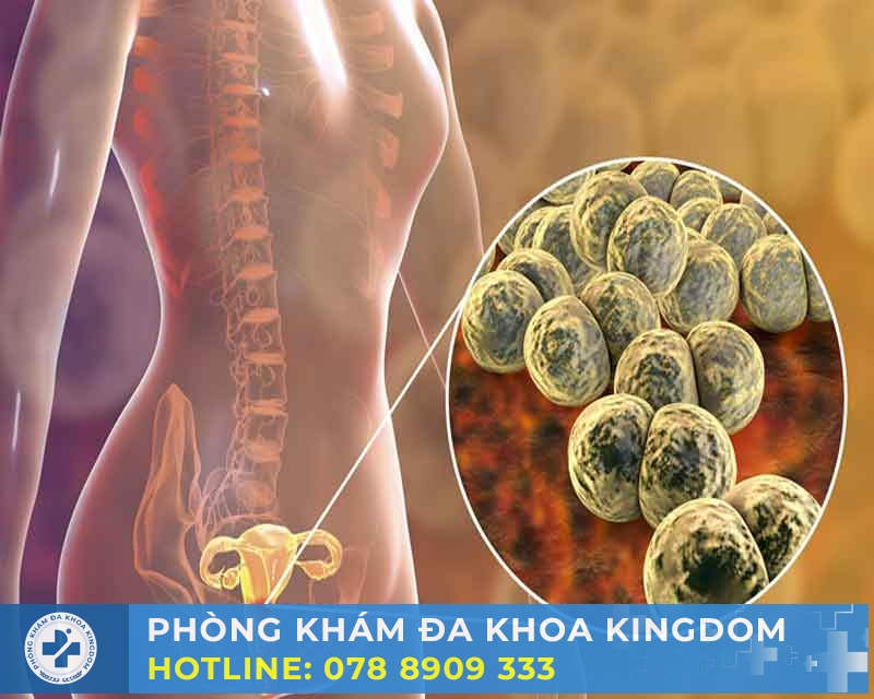 Điều trị bệnh lậu giai đoạn đầu chi phí tối ưu, hiệu quả cao