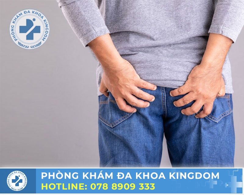 Bệnh trĩ cần được điều trị sớm để có hiệu quả tốt