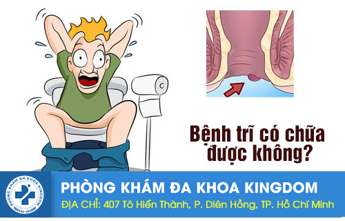 Bệnh trĩ có chữa được không? Cách chữa hiệu quả?