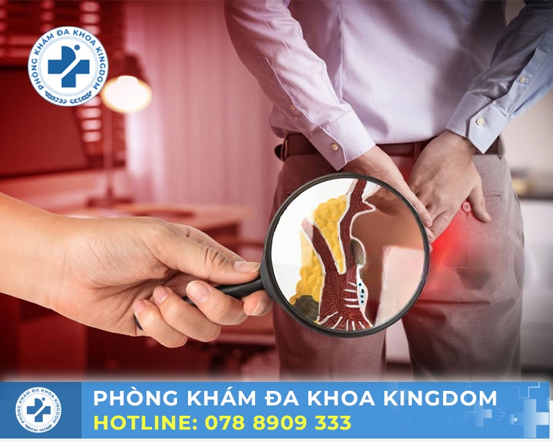 Nỗi ám ảnh luôn thường trực trong đầu bệnh nhân bệnh trĩ