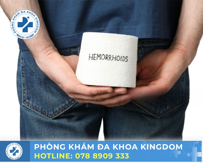 Bệnh trĩ ngoại cần được điều trị sớm để mang lại hiệu quả cao