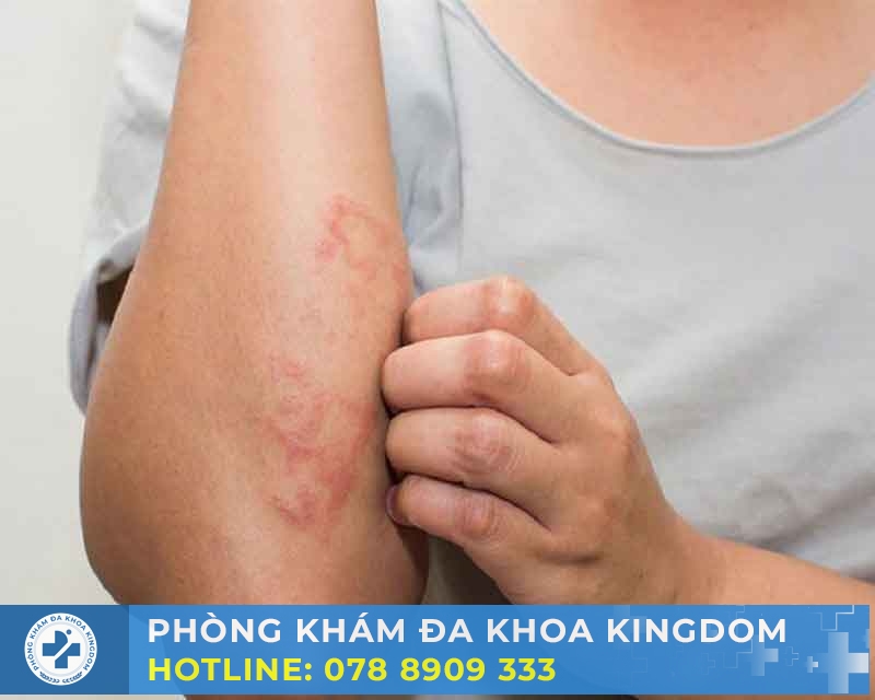 Nguyên nhân và rủi ro khi bệnh xã hội xảy ra 