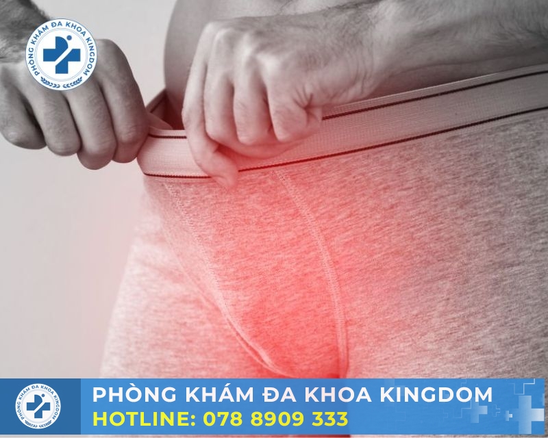Làm sao để chữa viêm bao quy đầu hiệu quả