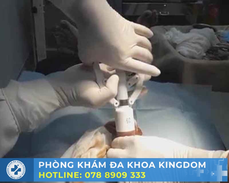 Quy trình và phương pháp cắt dây hãm bao quy đầu: an toàn và hiệu quả