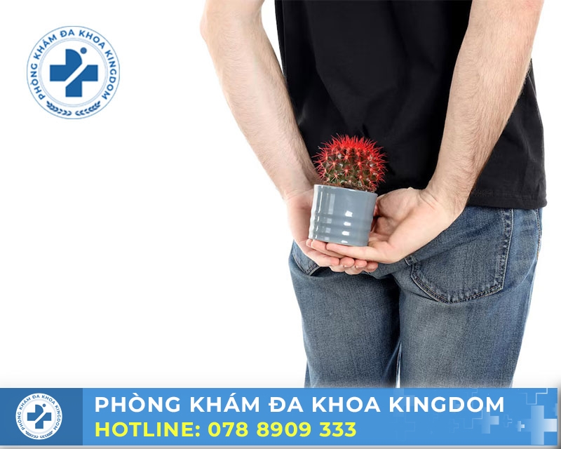 Nhận biết dấu hiệu bệnh trĩ để điều trị hiệu quả, chi phí tốt