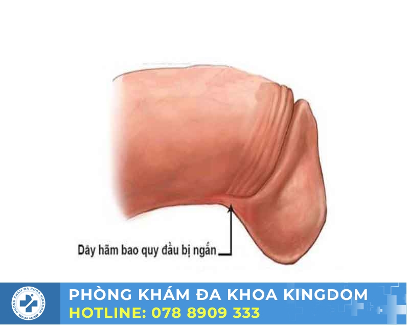 Tầm quan trọng của khám và điều trị sớm 