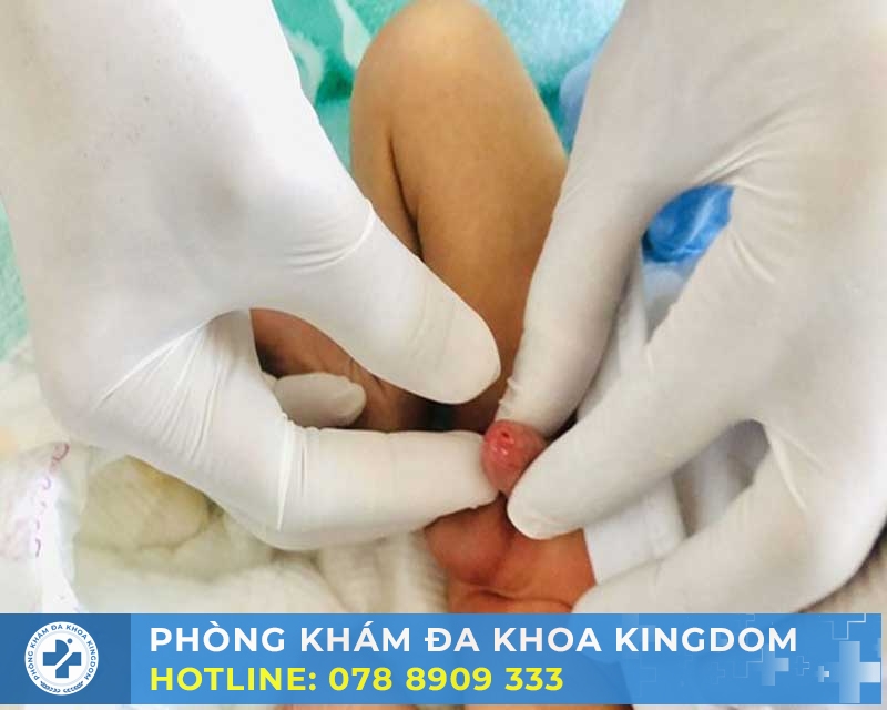Hẹp bao quy đầu: Giải pháp điều trị hiệu quả với chi phí hấp dẫn