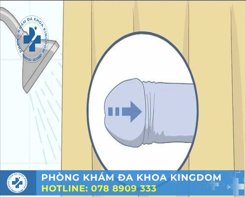 Hướng dẫn và lời khuyên chăm sóc
