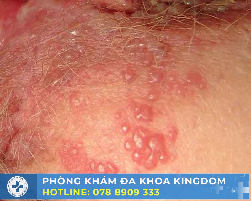 Hiểu rõ về 