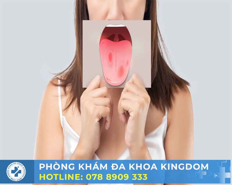 Giải đáp thắc mắc quan hệ bằng miệng có lây bệnh xã hội?