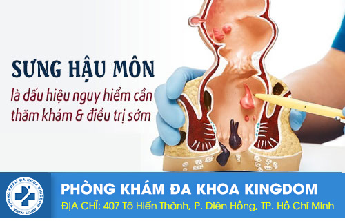 Điều trị sưng đau hậu môn như thế nào?