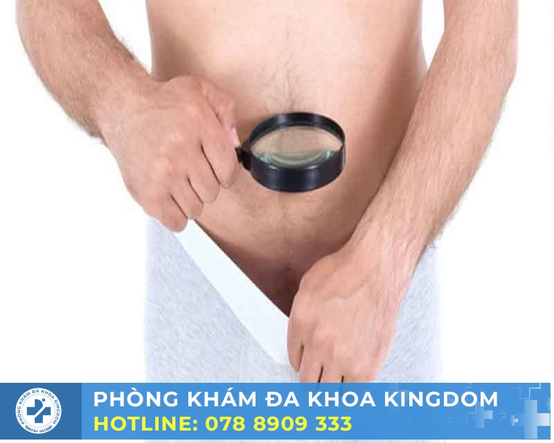 Giải pháp tuột bao quy đầu chi phí hợp lý, an toàn