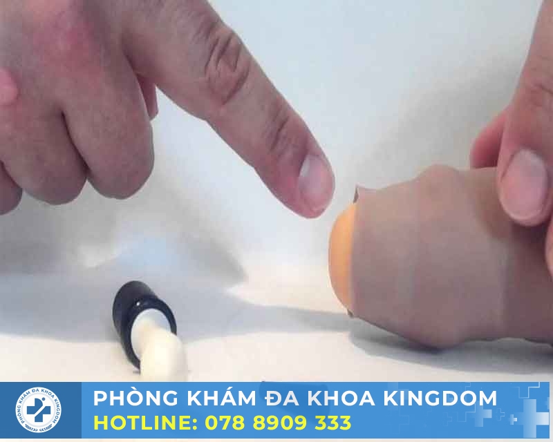 Hướng dẫn tụt lột bao quy đầu chi phí hợp lý, an toàn
