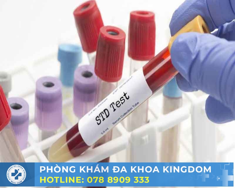 Xét nghiệm bệnh xã hội chi phí hấp dẫn, nhanh chóng, chính xác