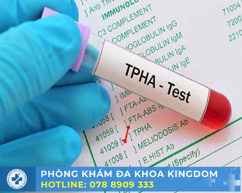 Xét nghiệm giang mai chi phí hợp lý, nhanh chóng, chính xác