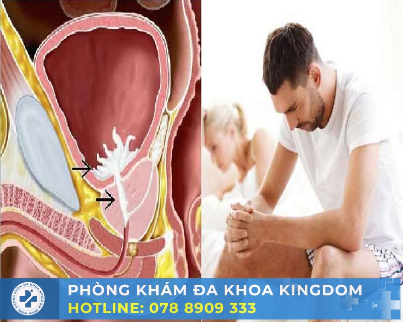 Xuất tinh ngược dòng có nguy hiểm? Tư vấn điều trị chi phí tốt