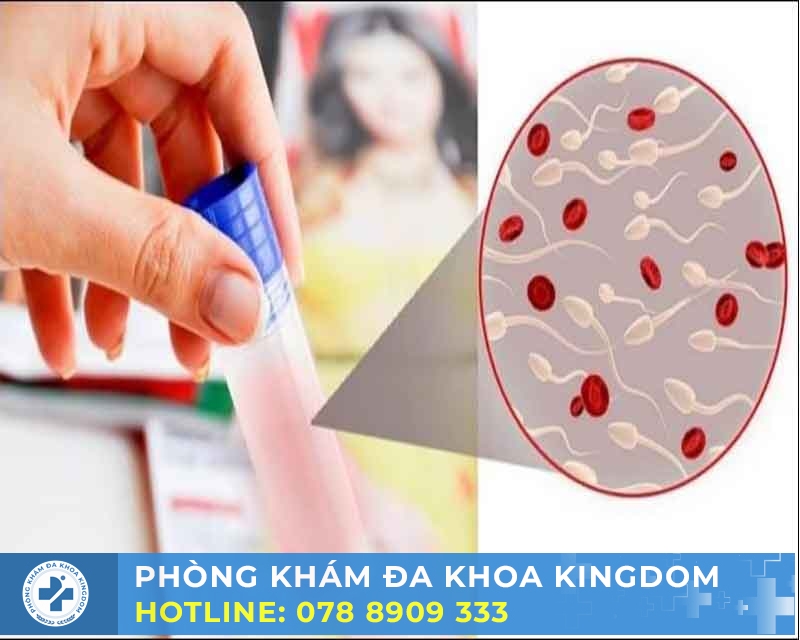 Xuất tinh ra máu có nguy hiểm không? Điều trị nhanh chóng, chi phí tốt nhất