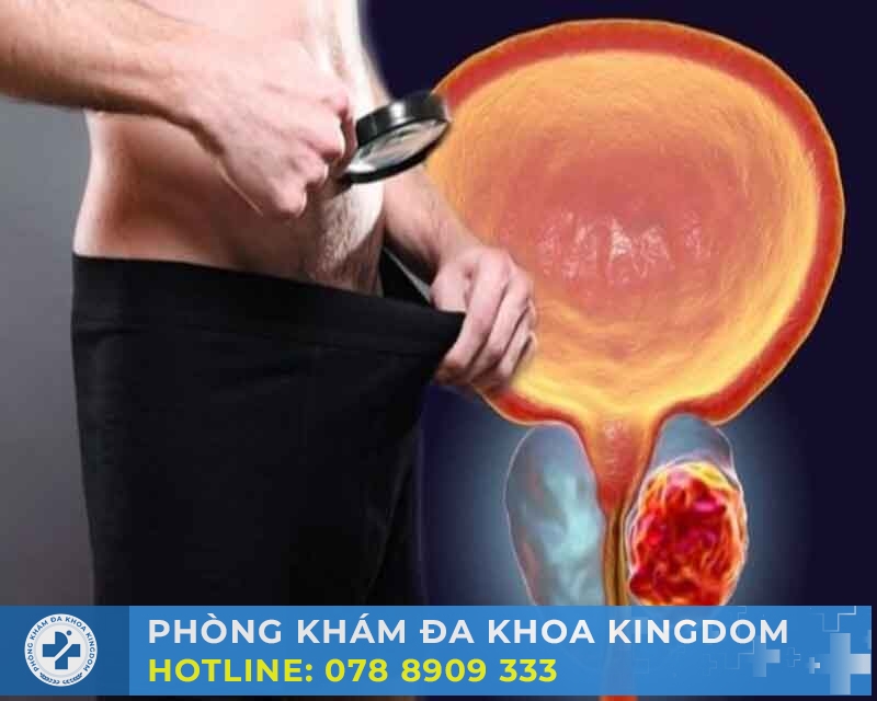 Xuất Tinh Ra Máu Có Nguy Hiểm Không? Phân Tích Từ Góc Nhìn Y Học 